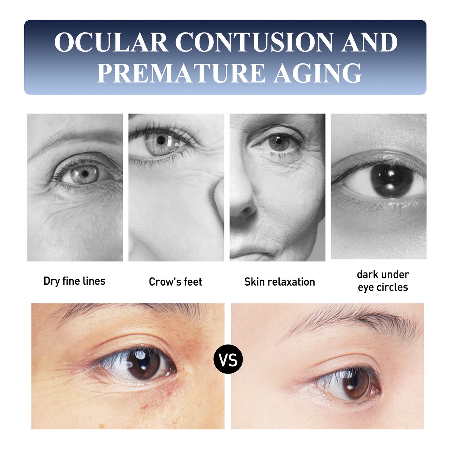 Anti-aging Moisturizing Cream Lifting & Tightening Fine Lines Repair